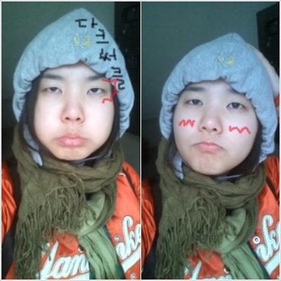 �۱����� ���� 뽜�̶�